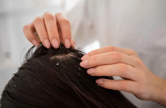 أساليب تنظيف فروة الرأس للحفاظ على شعر صحي