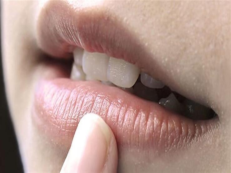 تصبغ الشفاه ..  عادات يومية وأسباب تسرق لونها الطبيعي 