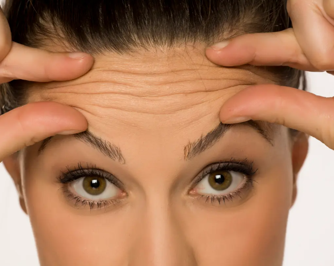 دون بوتكس أو حقن ..  طرق بسيطة للتخلص من 6 تجاعيد شائعة 