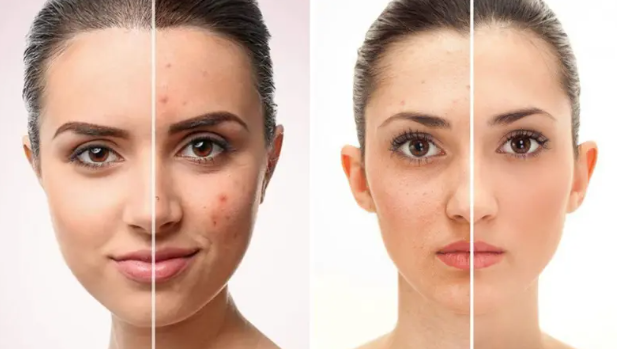 لكل مشكلة تجميلية تركيبة مكونات تناسبها