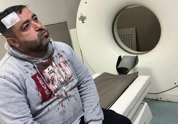 ضبط المعتدين على الزميل الصحفي فيصل التميمي