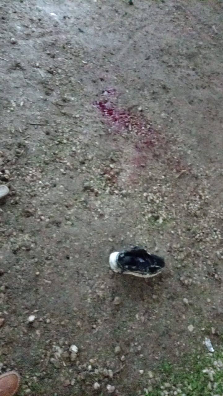 33 إصابة بانفجار غامض خلال حفل زفاف في درعا 