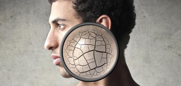 Dry skin and dealing with it |  Mix