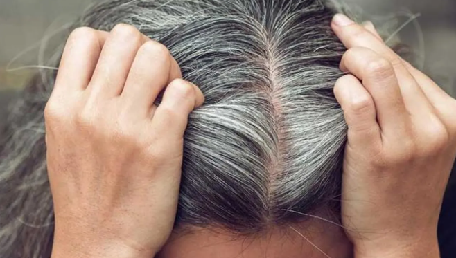 بدون صبغات ..  السر الطبيعي الأقوى لإخفاء الشعر الأبيض!