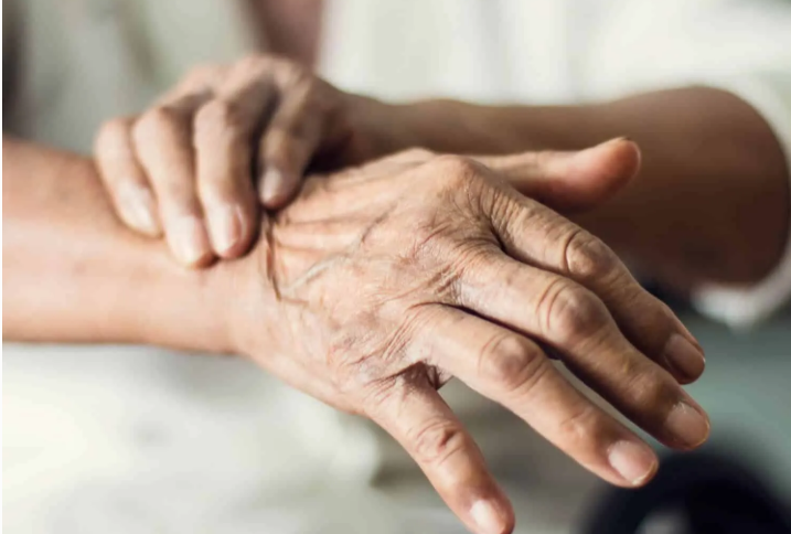 الباركنسون في يومه العالمي ..  تحديات أردنية حول ارتفاع كلف العلاج وصعوبة التشخيص المبكر