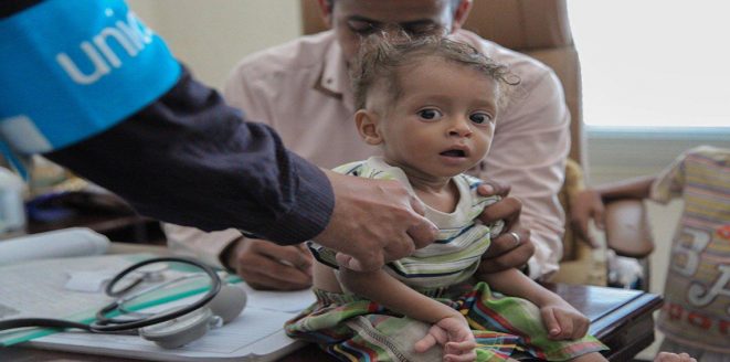 وباء الكوليرا يهدد اليمن من جديد