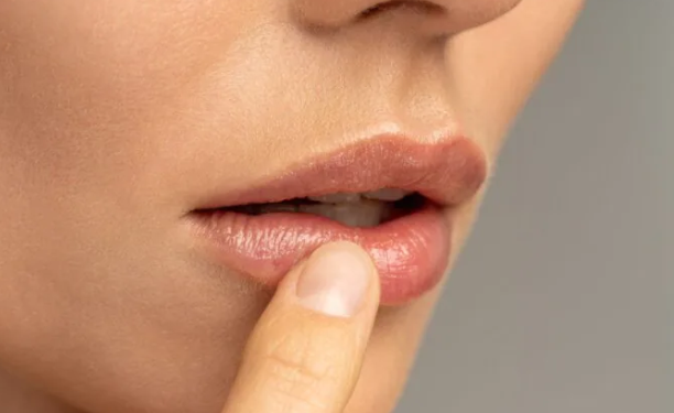 7 علاجات فعالة للتخلص من تشقق الشفاه في الشتاء