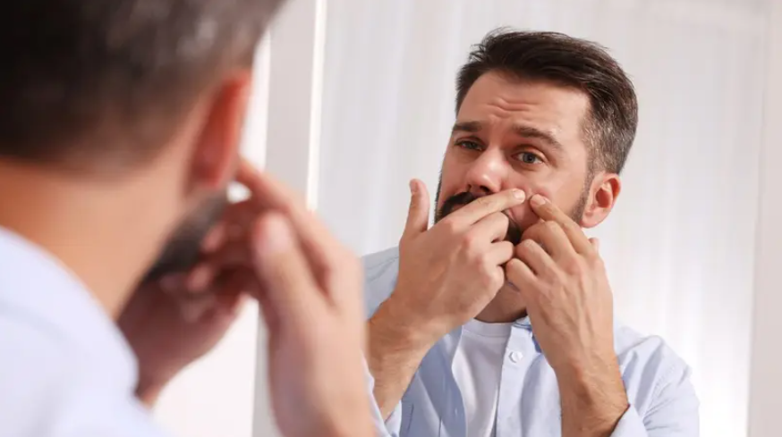 الواي بروتين وحب الشباب .. هذا هو الرابط الخفي بينهما