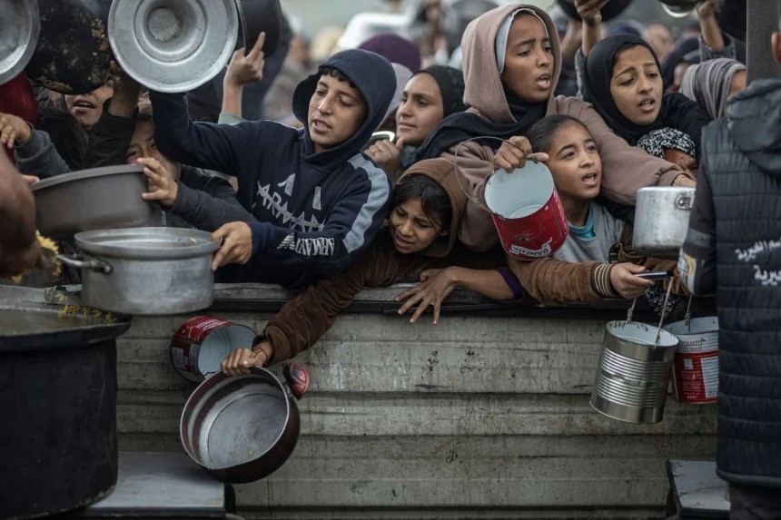 صحة غزة: وصول معدلات سوء التغذية إلى مستويات كارثية