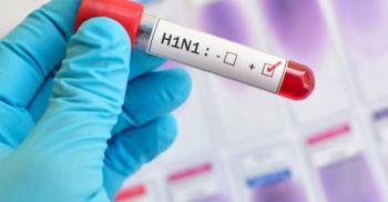 تسجيل إنفلونزا الخنازير في 74 منطقة روسية