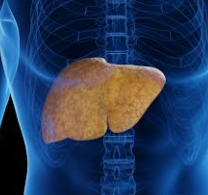 أعراض بسيطة قد تكشف إصابتك بالكبد الدهني