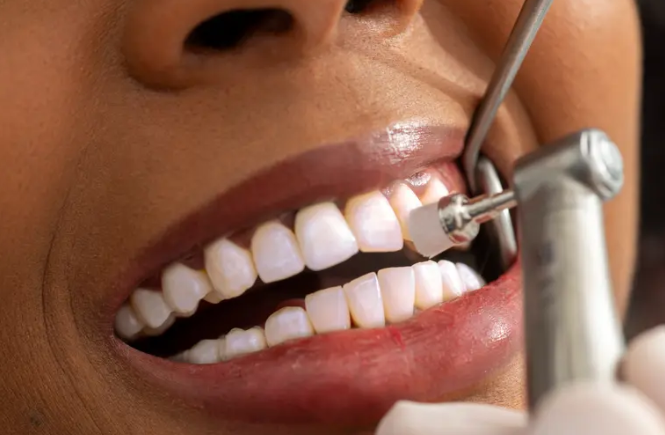 ابتكار جديد لوقاية الأسنان من التسوس ..  كيف يعمل؟